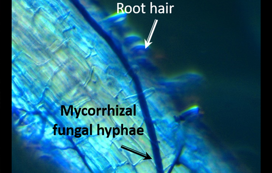 Mycorrhizal hyphae and Mulanje cedar root hairs